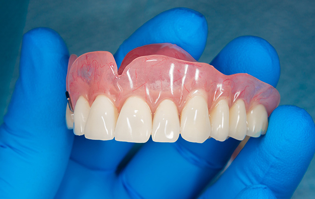 Dental professional holding prosthetic upper teeth denture with natural shade against blue gloved hand.