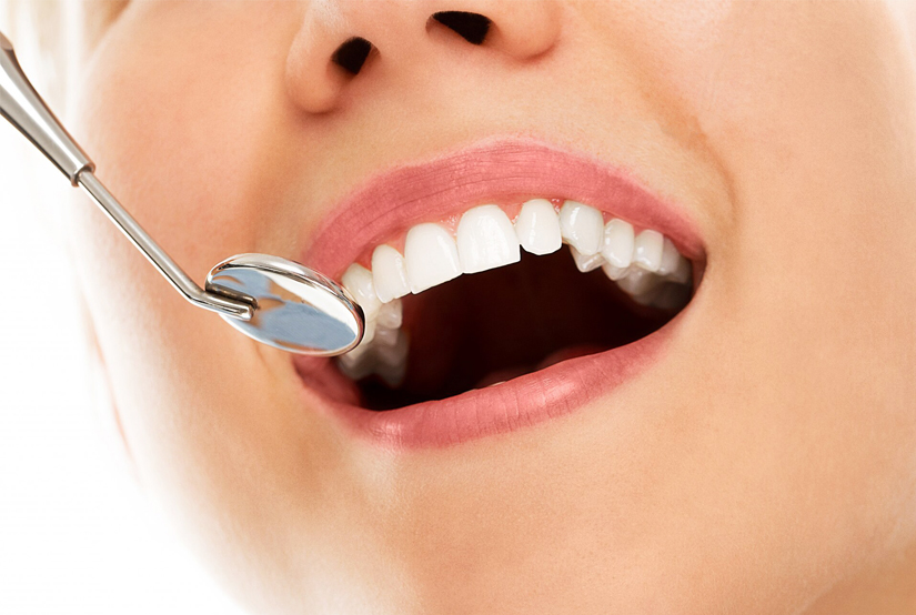 Patient receiving dental examination with mirror tool during professional teeth checkup visit.