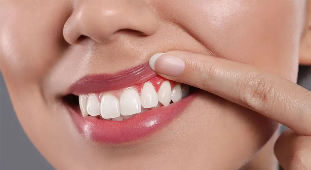 Close-up of smiling person pointing to healthy white teeth against neutral background.