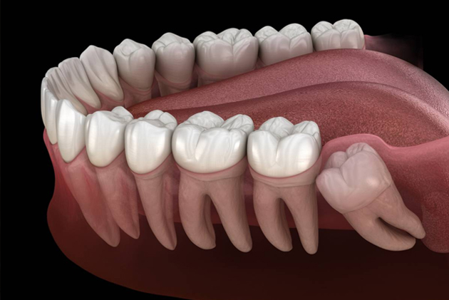 3D dental illustration showing natural teeth and gum anatomy in cross-section view