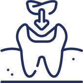 Tooth with dental crown and roots illustration representing dental care and treatment.