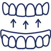 Dental bridge diagram showing upper and lower teeth with arrows indicating placement connection.