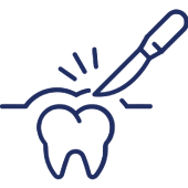 Dental tool treating tooth with light rays, representing professional dental care and treatment.