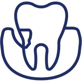 Tooth illustration with protective hand gesture representing dental care and protection.